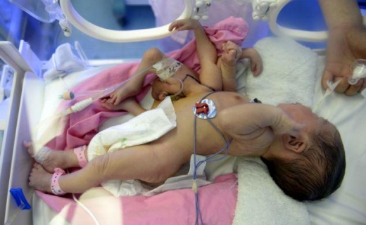 femija me kater kembe e duar