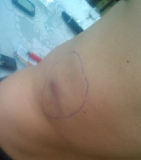 personi dhunuar korce