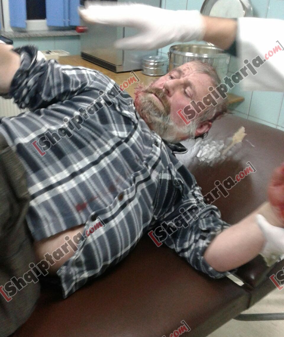 roja i grabitur lezhe karburanti