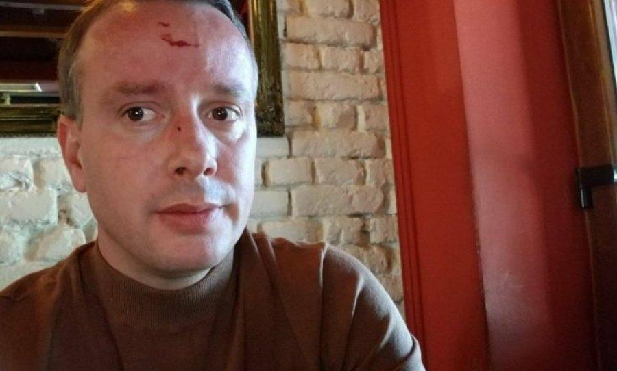 dhunohet gazetari