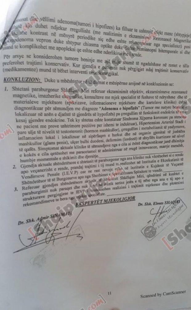 ekspertiza shkelqim miri