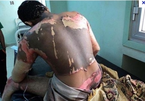 Gazetari bolivian Fernando Vidal