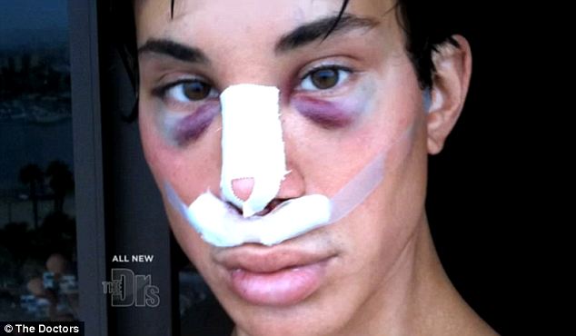 Justin Jedlica, njeriu silikon