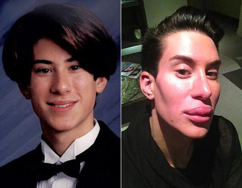 Justin Jedlica, njeriu silikon 